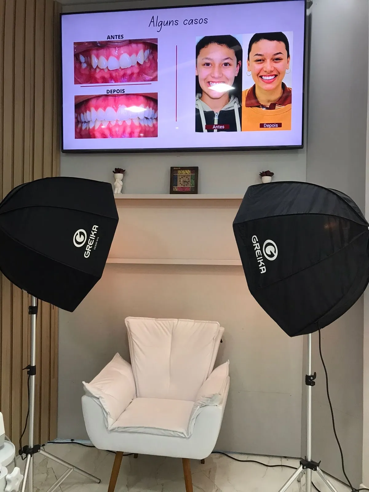 Estúdio fotográfico da clínica, com luzes de estúdio, poltrona e televisão
