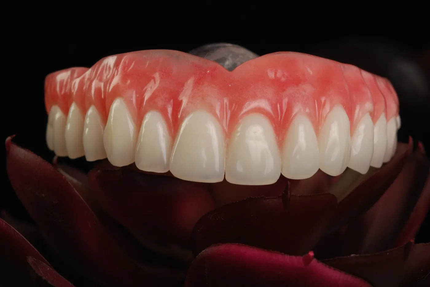 Prótese dentária total